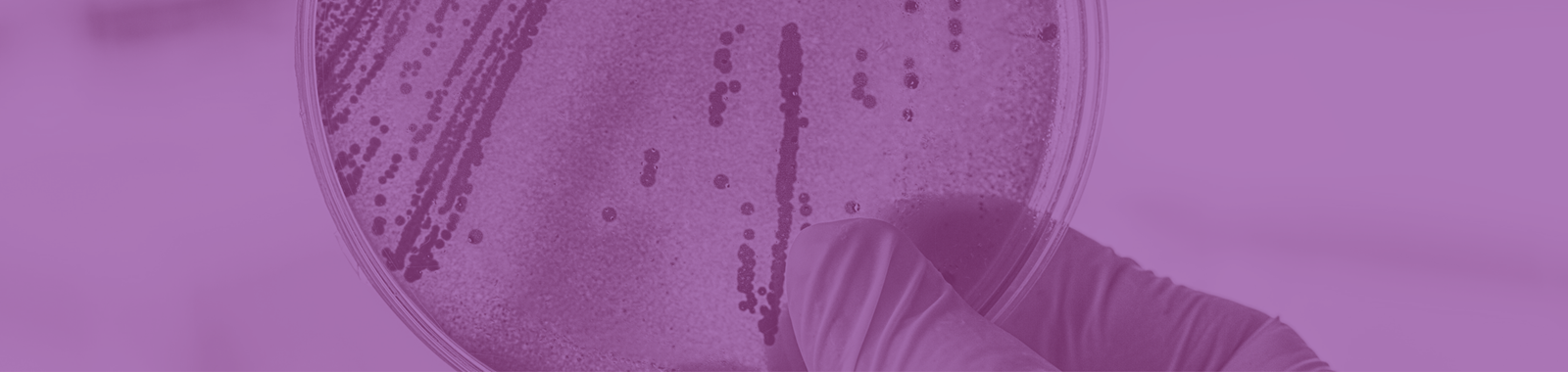 Understanding Risks from Botulinum in Foods