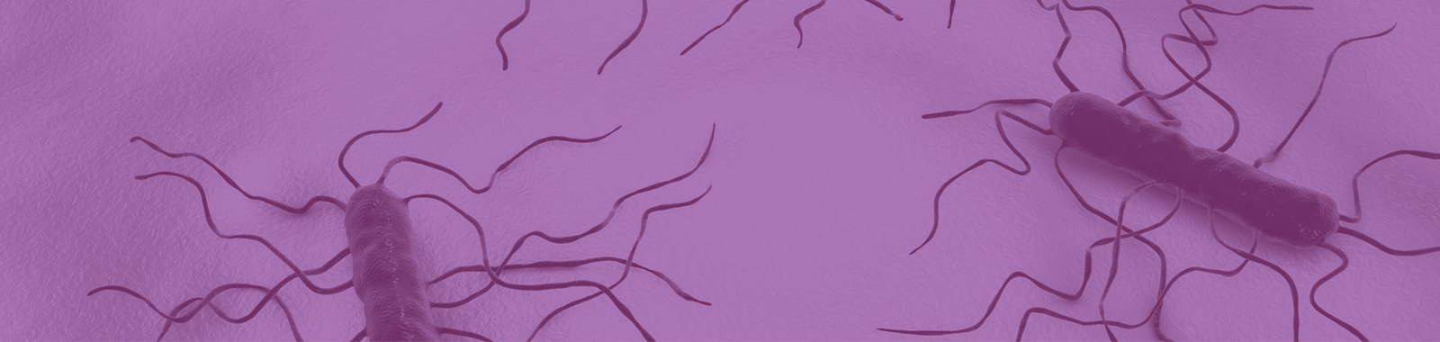 Listeria | Hazard Awareness, Monitoring, and Principles of Control