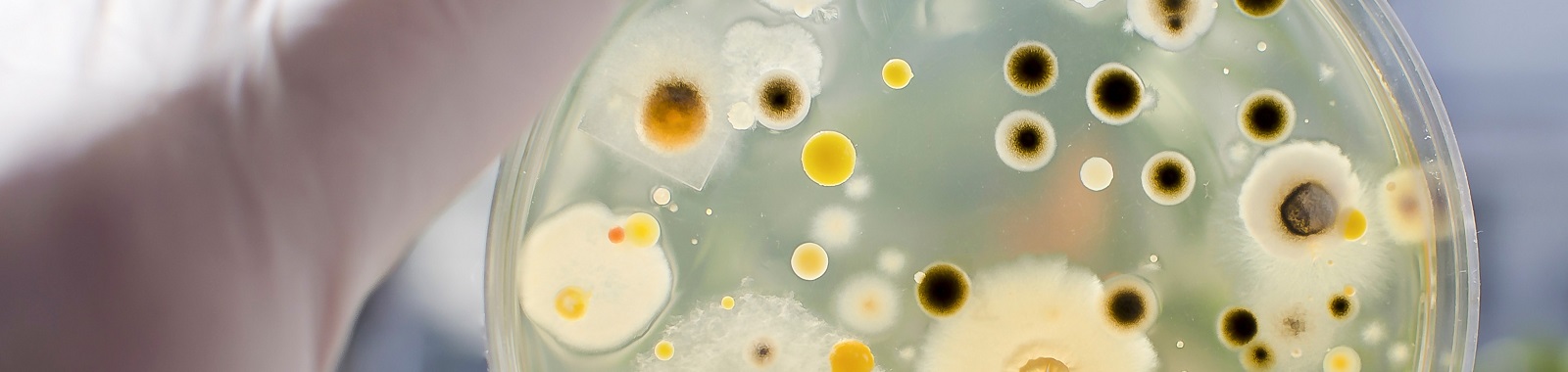 Rapid mould identification Banner